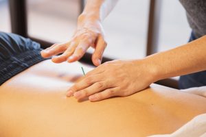 benefits acupuncture works eczema psoriasis